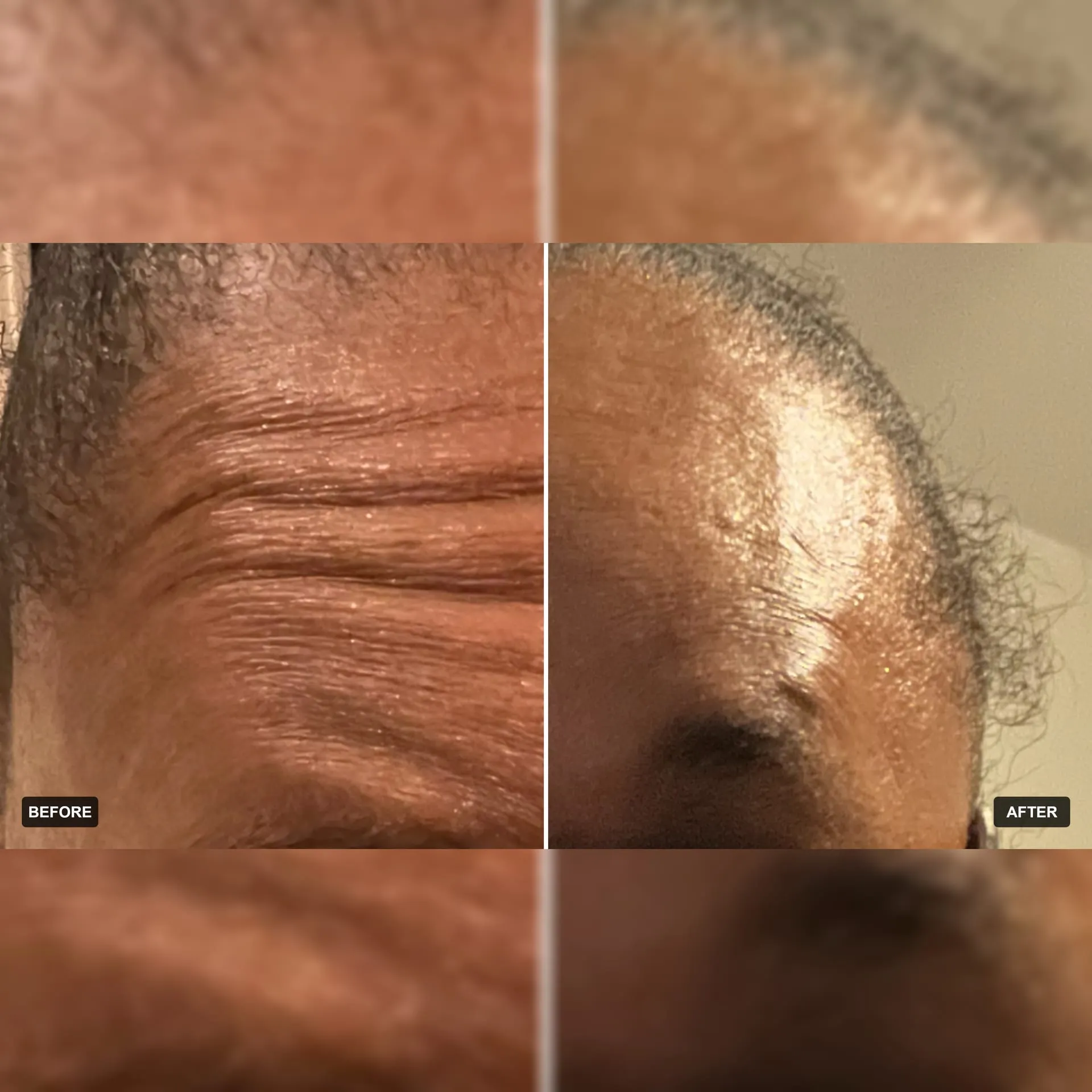 Before and after aesthetic treatment results